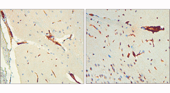 Phospho-Tau (Thr217) Rabbit Polyclonal Antibody