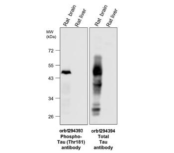 Phospho-Tau (Thr181) Rabbit Polyclonal Antibody