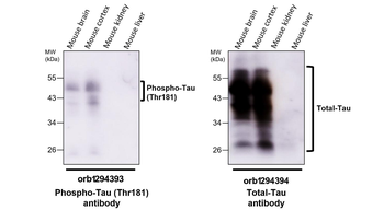 Phospho-Tau (Thr181) Rabbit Polyclonal Antibody