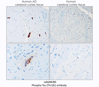 Phospho-Tau (Thr181) Rabbit Polyclonal Antibody