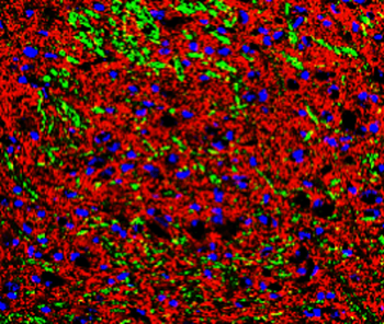 Phospho-Tau (Thr181) Rabbit Polyclonal Antibody