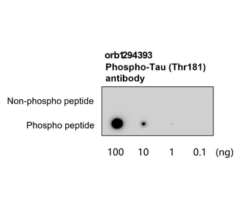 Phospho-Tau (Thr181) Rabbit Polyclonal Antibody