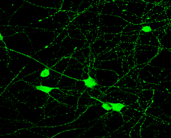 Tau Rabbit Polyclonal Antibody