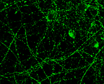 Tau Rabbit Polyclonal Antibody