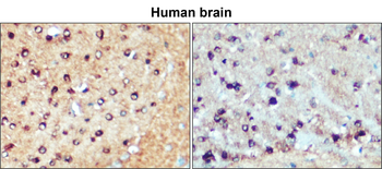 Tau Rabbit Polyclonal Antibody