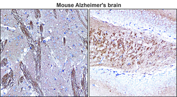 Tau Rabbit Polyclonal Antibody