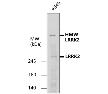 LRRK2 Rabbit Polyclonal Antibody