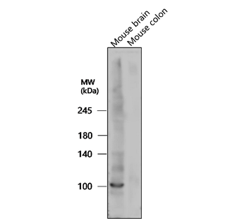 LRRK2 Rabbit Polyclonal Antibody