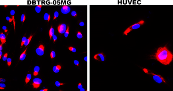 LRRK2 Rabbit Polyclonal Antibody