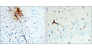 LRRK2 Rabbit Polyclonal Antibody