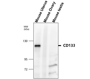 CD133 Rabbit Polyclonal Antibody