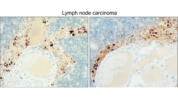 CD133 Rabbit Polyclonal Antibody