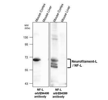 Neurofilament L Rabbit Polyclonal Antibody