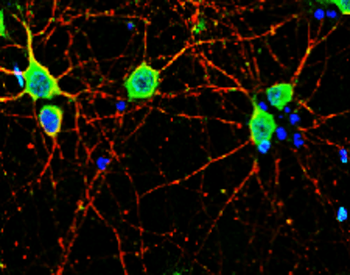 Neurofilament L Rabbit Polyclonal Antibody
