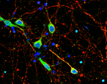 Neurofilament L Rabbit Polyclonal Antibody