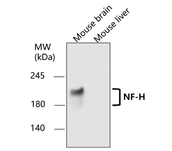 Neurofilament H Rabbit Polyclonal Antibody