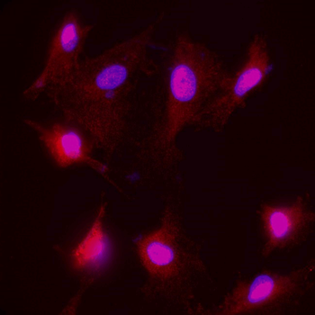 Neurofilament H Rabbit Polyclonal Antibody