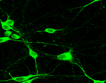 Neurofilament H Rabbit Polyclonal Antibody