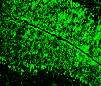 Neurofilament H Rabbit Polyclonal Antibody