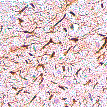 Neurofilament H Rabbit Polyclonal Antibody