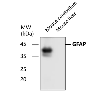 GFAP Rabbit Polyclonal Antibody