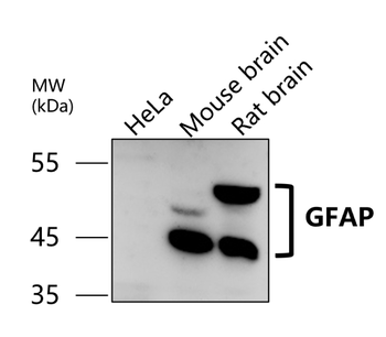 GFAP Rabbit Polyclonal Antibody