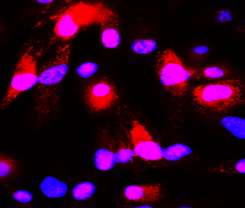 GFAP Rabbit Polyclonal Antibody