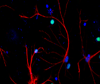 GFAP Rabbit Polyclonal Antibody