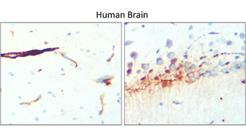 GFAP Rabbit Polyclonal Antibody