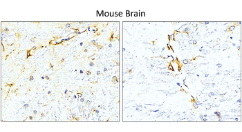 GFAP Rabbit Polyclonal Antibody