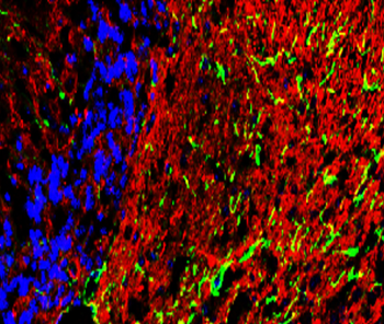 GFAP Rabbit Polyclonal Antibody