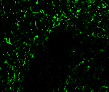 GFAP Rabbit Polyclonal Antibody