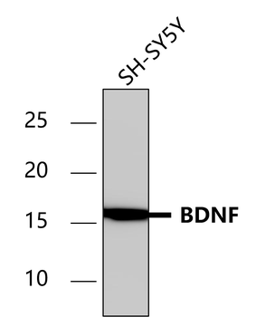 BDNF Rabbit Polyclonal Antibody