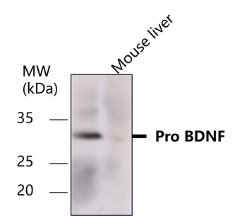 BDNF Rabbit Polyclonal Antibody