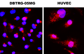 BDNF Rabbit Polyclonal Antibody