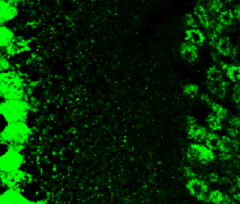 BDNF Rabbit Polyclonal Antibody