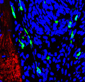 AIF Rabbit Polyclonal Antibody