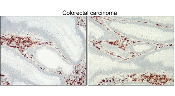 AIF Rabbit Polyclonal Antibody