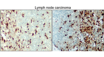 AIF Rabbit Polyclonal Antibody