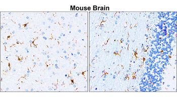 AIF Rabbit Polyclonal Antibody