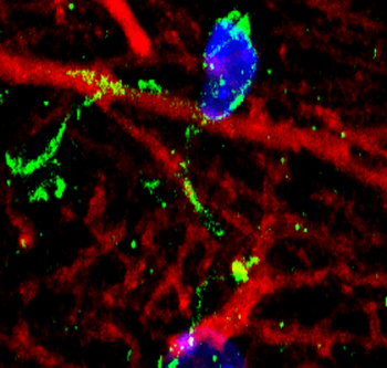AIF Rabbit Polyclonal Antibody