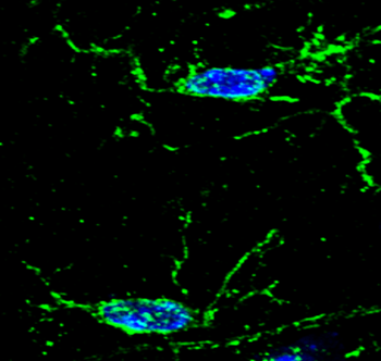 AIF Rabbit Polyclonal Antibody