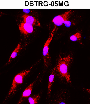 MAP2 Rabbit Polyclonal Antibody