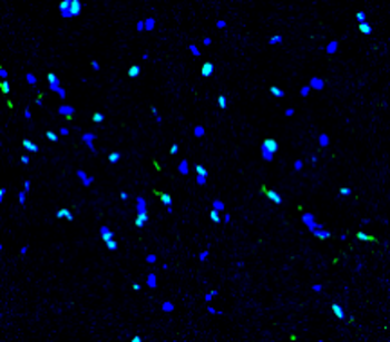 SOX2 Rabbit Polyclonal Antibody