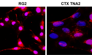 NOTCH1 Rabbit Polyclonal Antibody