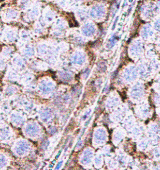GAPDH Rabbit Polyclonal Antibody