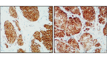 Beta-actin Rabbit Polyclonal Antibody