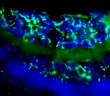 Enolase-2 Rabbit Polyclonal Antibody