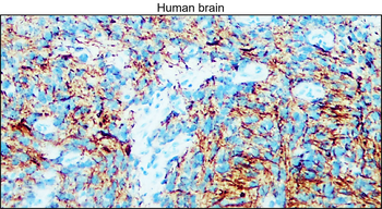 Enolase-2 Rabbit Polyclonal Antibody