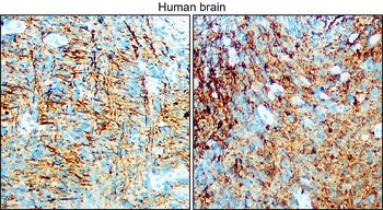 Enolase-2 Rabbit Polyclonal Antibody
